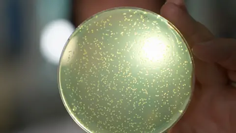 BBC News A petri dish lit up with a bright light with white spots of yeast.