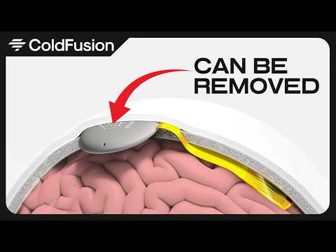 The Race to Control Our Brains Is Heating Up