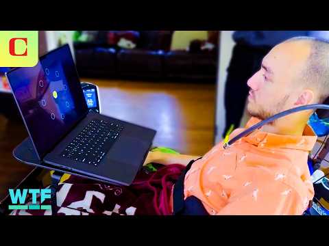 Synchron vs. Neuralink: BCI Brain Implants for Thought-Control