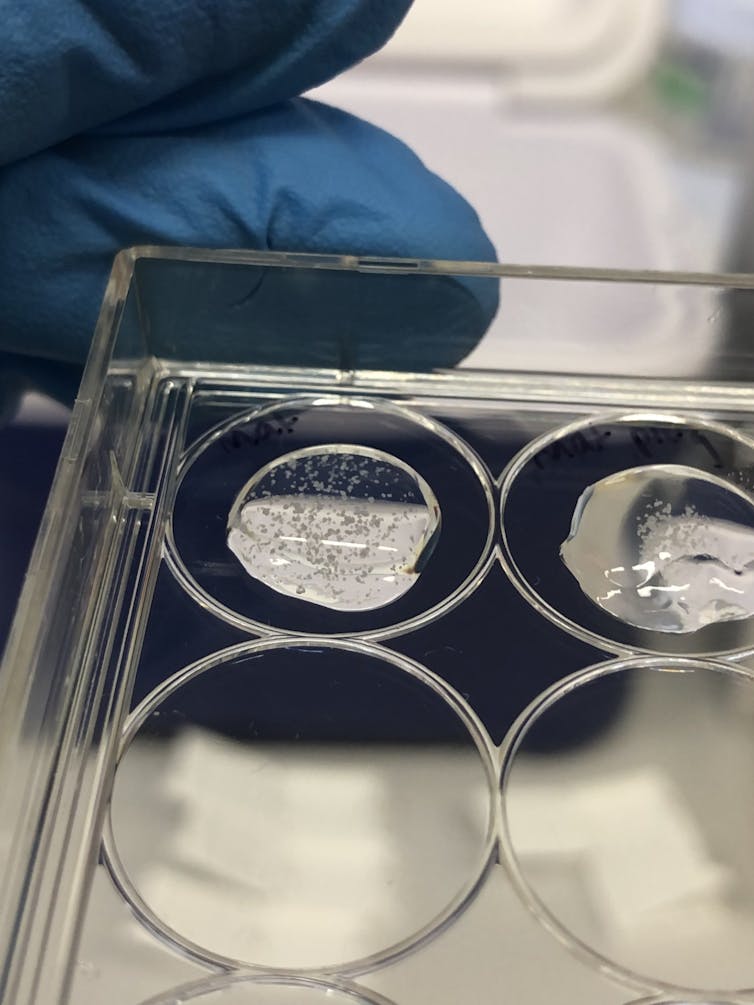 A gloved hand holding a clear plastic tray containing puddles of gel with tiny blobs in them