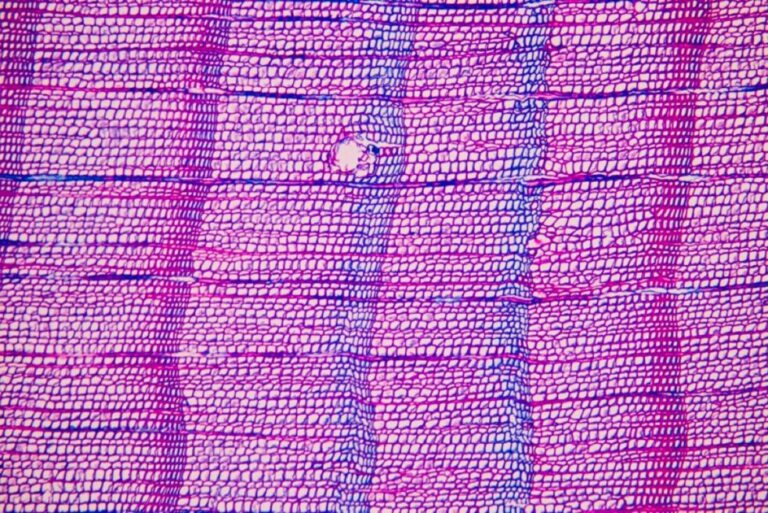 Rare set of varied factors triggered Black Death