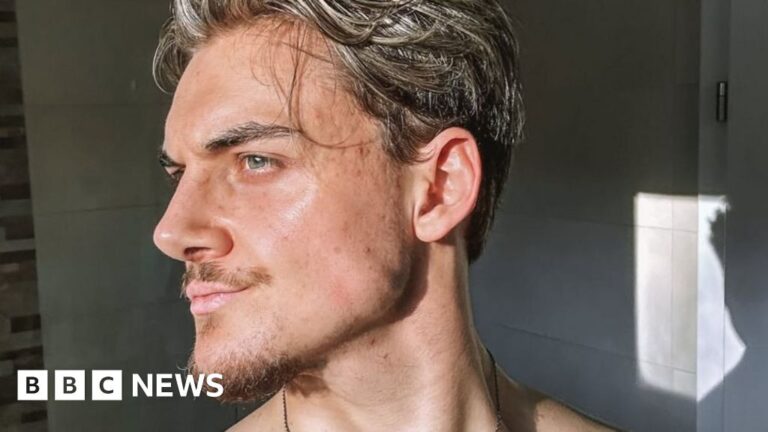 Sculpting jaws, giving scores: Inside the world of looksmaxxing