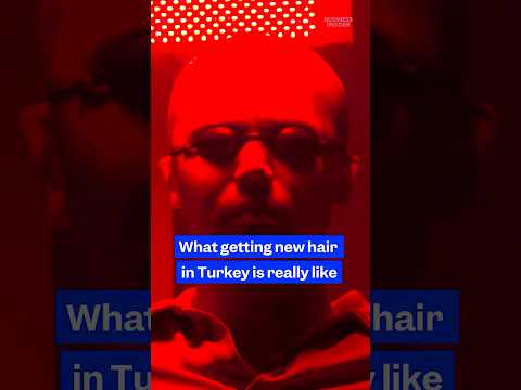 Here's what getting new #hair in #Turkey is really like. #hairtransplant