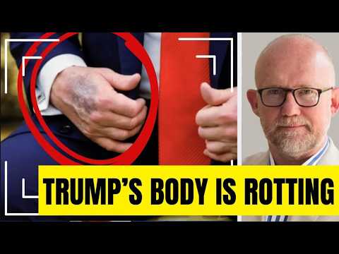 Rick Wilson’s GRIM CONFESSION About Trump’s SECRET ILNESS Has MAGA Fearing the Worst