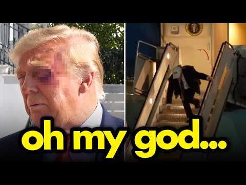 Trump fell..